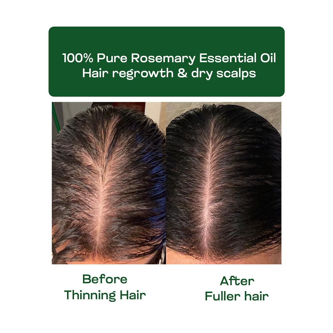 Rosemary Essential Oil 15ml — View 6