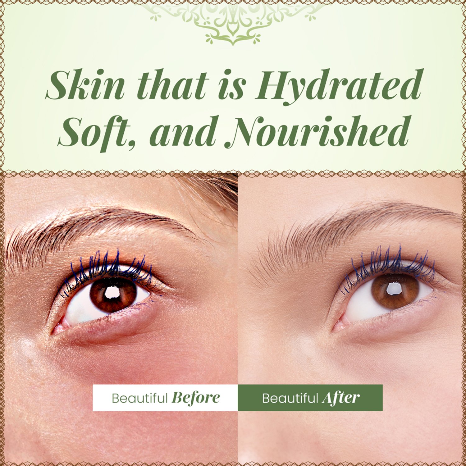 Pure Aloe Vera Gel - 100gm — View 3